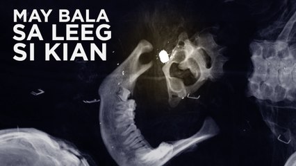 May bala pa sa katawan ni Kian  Paano ito nangyari_