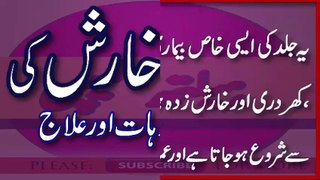 Kharish Ka Asan Ilaj Eczema Treatment In Urdu How To Cure Eczema