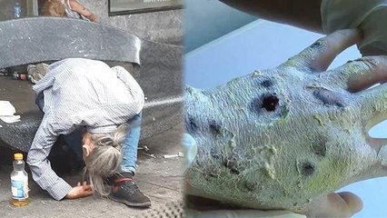 Zombie Drug क्या है, Skin सड़ने की वजह चौंकाने वाली | Boldsky