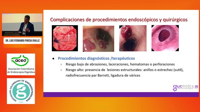 Enfermedades iatrogénicas o accidentales (Píldora – caustico- cuerpo extraño). Abordaje del paciente con trastornos esofágicos. Dr. Luis Fernando Pineda Ovalle.