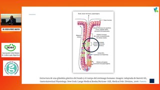 Fisiología de la secreción ácida – Enfermedad ulcerosa péptica – Gastropatía por AINES.  Dr. Diego Aponte Martin.