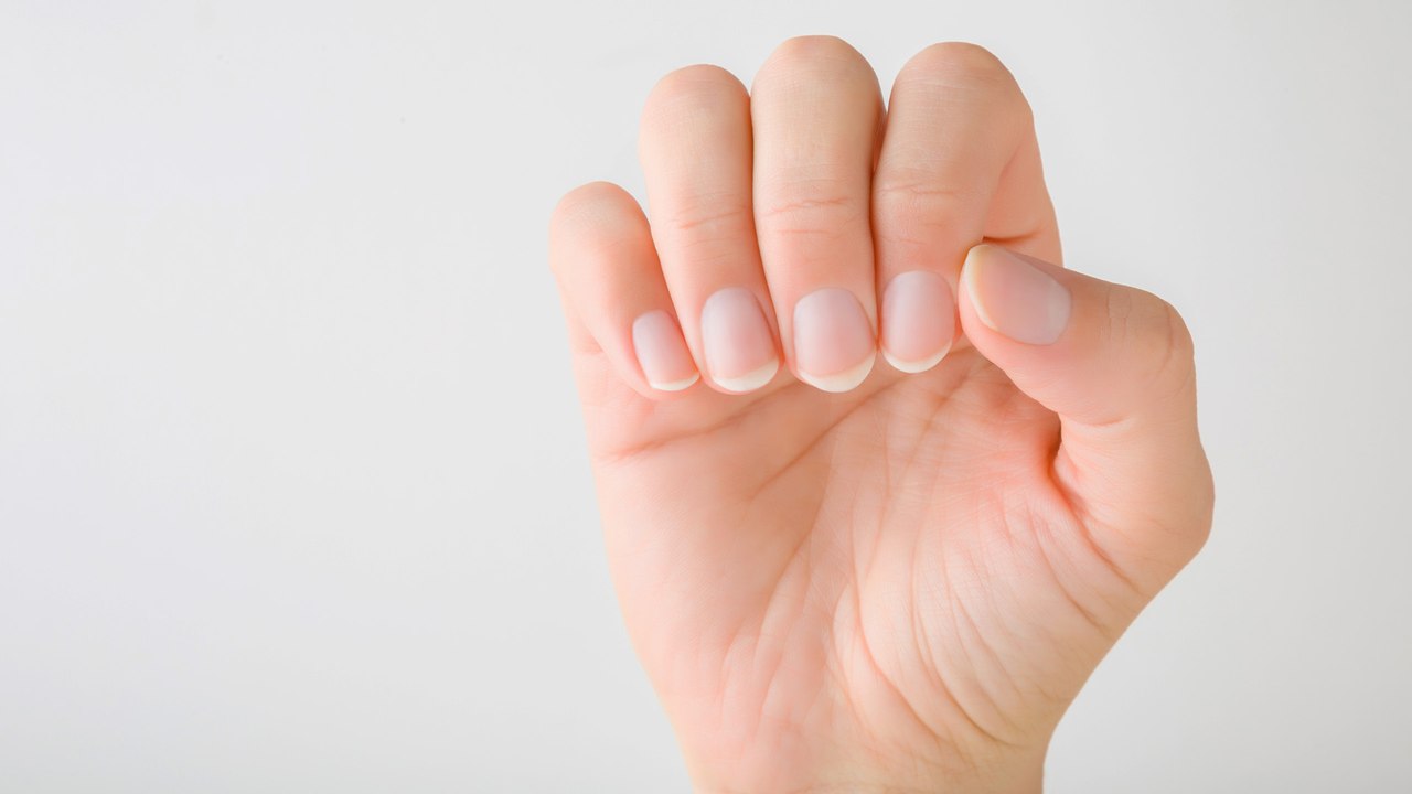 Gelbe Fingernägel: Mit diesen Blitz-Tipps bekommst du sie wieder weiß