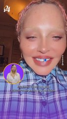 "¿Qué se hizo en la cara?" Madonna causa revuelo en redes sociales por la forma de su rostro