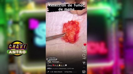 'Mimy Regia' confiesa su lucha contra el cáncer