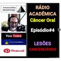 CÂNCER ORAL| ASPECTO CLINICO| LESÕES  CANCERIZÁVEIS |PODCAST EM VÍDEO
