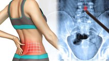Spinal Chord Pain क्यों होता है, रीढ़ के हड्डी में दर्द होना इस गंभीर बीमारी का लक्षण | Boldsky