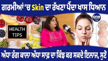 ਗਰਮੀਆਂ‘ਚ Skin ਦਾ ਰੱਖਣਾ ਪੈਂਦਾ ਖਾਸ ਧਿਆਨ, ਅੱਧਾ ਰੰਗ ਕਾਲਾ ਅੱਧਾ ਸਾਫ਼ ਦਾ ਕਿੰਝ ਕਰ ਸਕਦੇ ਇਲਾਜ|OneIndia Punjabi