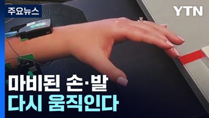 마비된 손·발 다시 움직인다...전자 칩 이식 기술 주목 / YTN