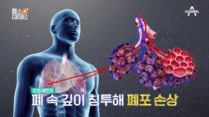 봄과 함께 찾아오는 불청객 미세먼지와 황사로부터 건강을 지키는 방법은?