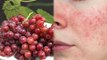 Red Grapes खाने से क्या होता है | लाल अंगूर खाने के फायदे | Boldsky *health