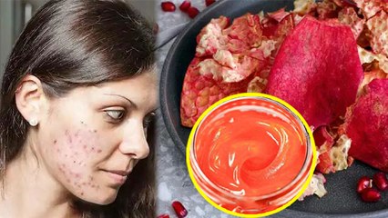 चेहरे पर अनार का छिलका लगाने के फायदे | चेहरे पर अनार का छिलका लगाने से क्या होता है | Boldsky