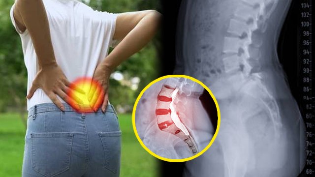 झुकने पर कमर में दर्द क्यों होता है | Jhukne Par Kamar Dard Kyu Hota Hai | Boldsky