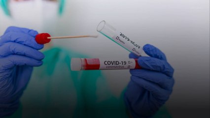 La pandémie de covid-19 causée par une fuite dans un laboratoire chinois ?
