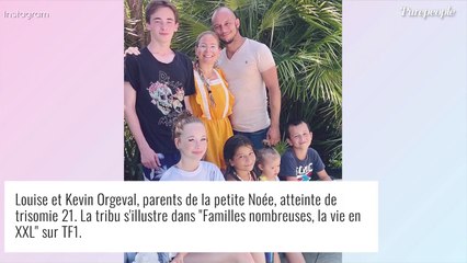 Familles Nombreuses : Une maman cède à la chirurgie esthétique et lève le voile sur le surprenant résultat