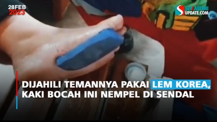 Dijahili Temannya Pakai Lem Korea, Kaki Bocah Ini Nempel di Sendal