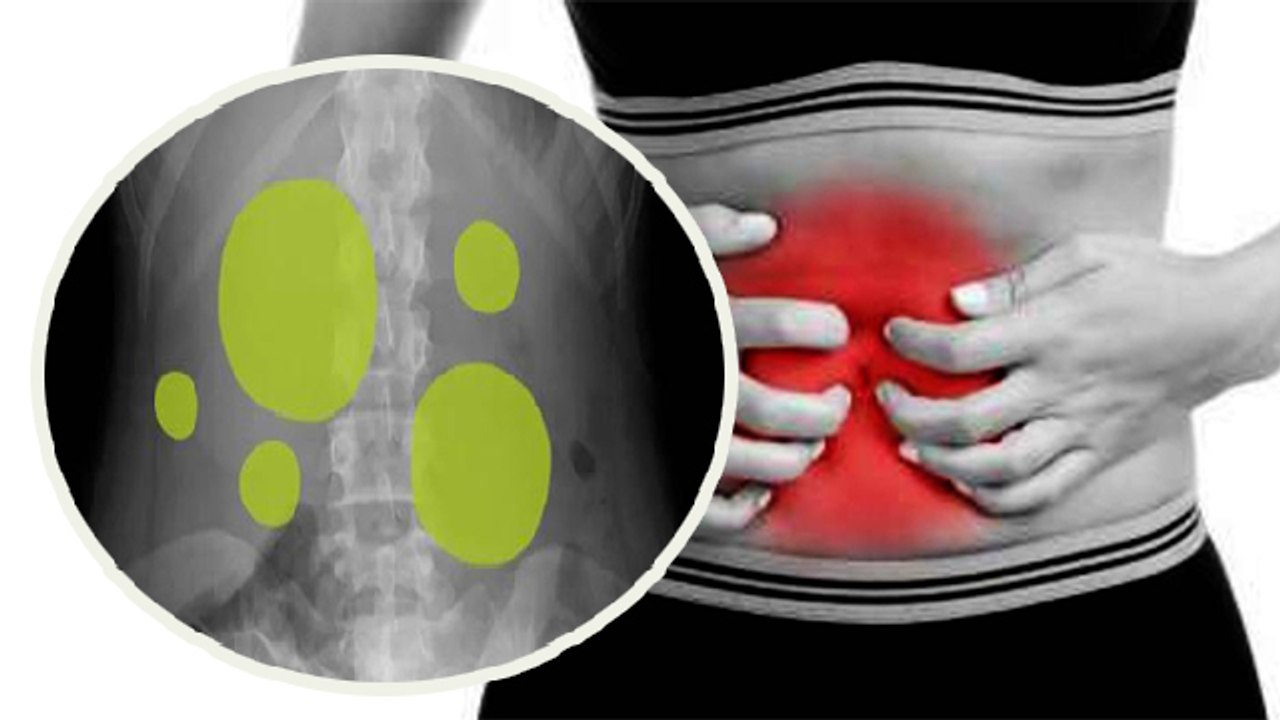 पेट के दाईं तरफ गैस क्यों बनती है | Pet Me Dai Taraf Gas Kyu Banti Hai | Boldsky