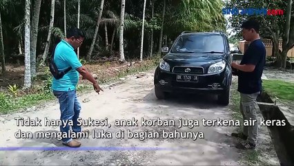 Diduga Kesal Ditinggal Istri Bekerja, Seorang Pria Siram Istri dan Anak dengan Air Keras