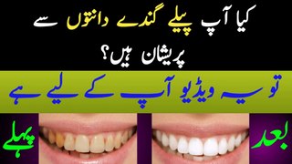 How to Whiten Teeth Naturally with 5 Simple Home Remedies | Teeth Whitening Home Remedies | #Teeth