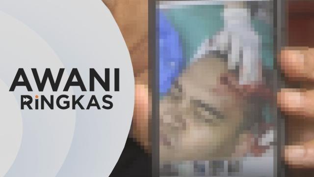 AWANI Ringkas: Lelaki bawa dadah tetak kepala polis