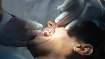bd-causas-y-tratamientos-de-anomalias-dentales-010323