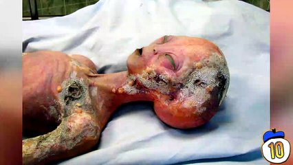 15 Weirdest Things Ever Done To A Corpse