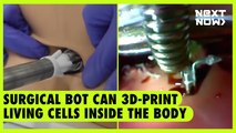 Surgical bot can 3D-print living cells inside the body | Next Now