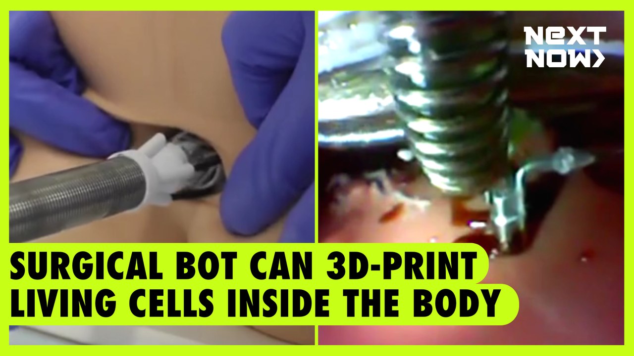 Surgical bot can 3D-print living cells inside the body | Next Now