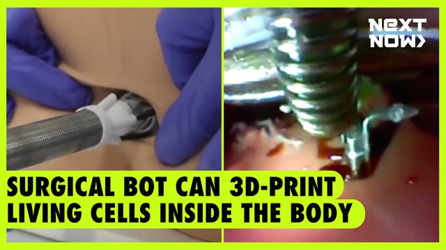Surgical bot can 3D-print living cells inside the body | Next Now