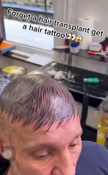 Chauve, il se fait tatouer des cheveux sur le crane