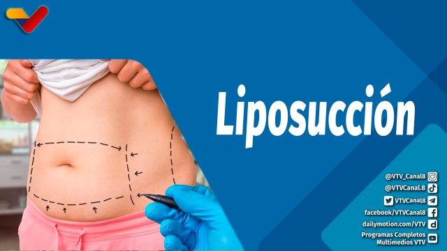 Actitud Saludable | ¿Cuáles son los riesgos y beneficios de una liposucción?