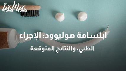 ابتسامة هوليوود الإجراء الطبي، والنتائج المتوقعة