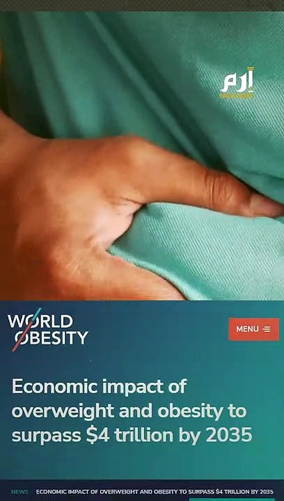 بحلول 2035.. السمنة تهدد أكثر من نصف سكان الأرض