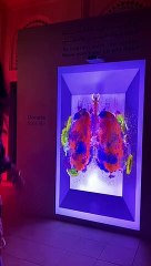 Organ donation in UAE