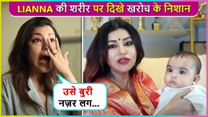 Debina Bonnerjee CRIED Badly After Seeing Scratches Marks On Lianna's Body, Says ' Usko Buri Nazar...