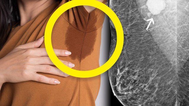 बगल में पसीना क्यों आता है | Bagal Mein Pasina Kyon Aata Hai | Boldsky