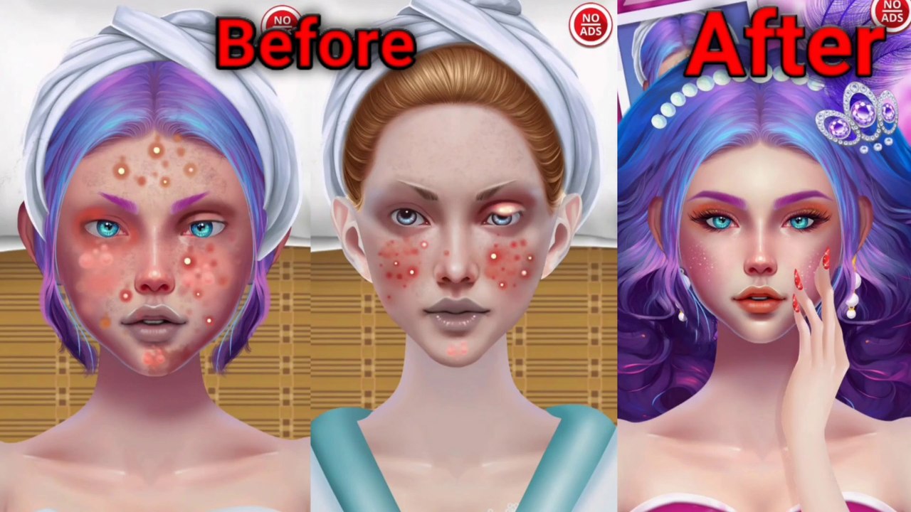 ASMR Dirty Hairly Face Lice & Big Acne Removal | Deep Cleaning Animation #asmr#viralvideo #asmrvideo