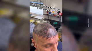 Una medida desesperada: se tatuó un peluquín en la cabeza por su falta de cabello