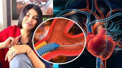 Sushmita Sen Heart Attack के बाद बताया अपना हाल ,Heart Blockage कितना Percentage होना खतरनाक