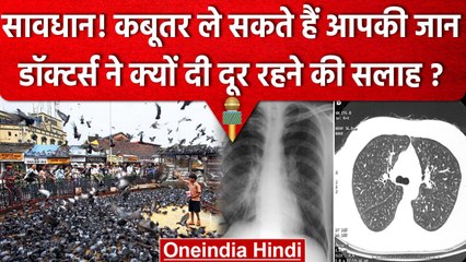 Hypersensitive Pneumonia का कारण बन रहे हैं Pigeons, डॉक्टर्स ने दी ये सलाह | वनइंडिया हिंदी