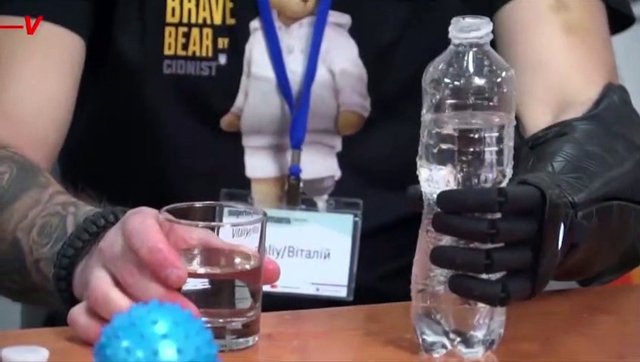Ukrainian Bionics Startup Begins Outfitting Inj...