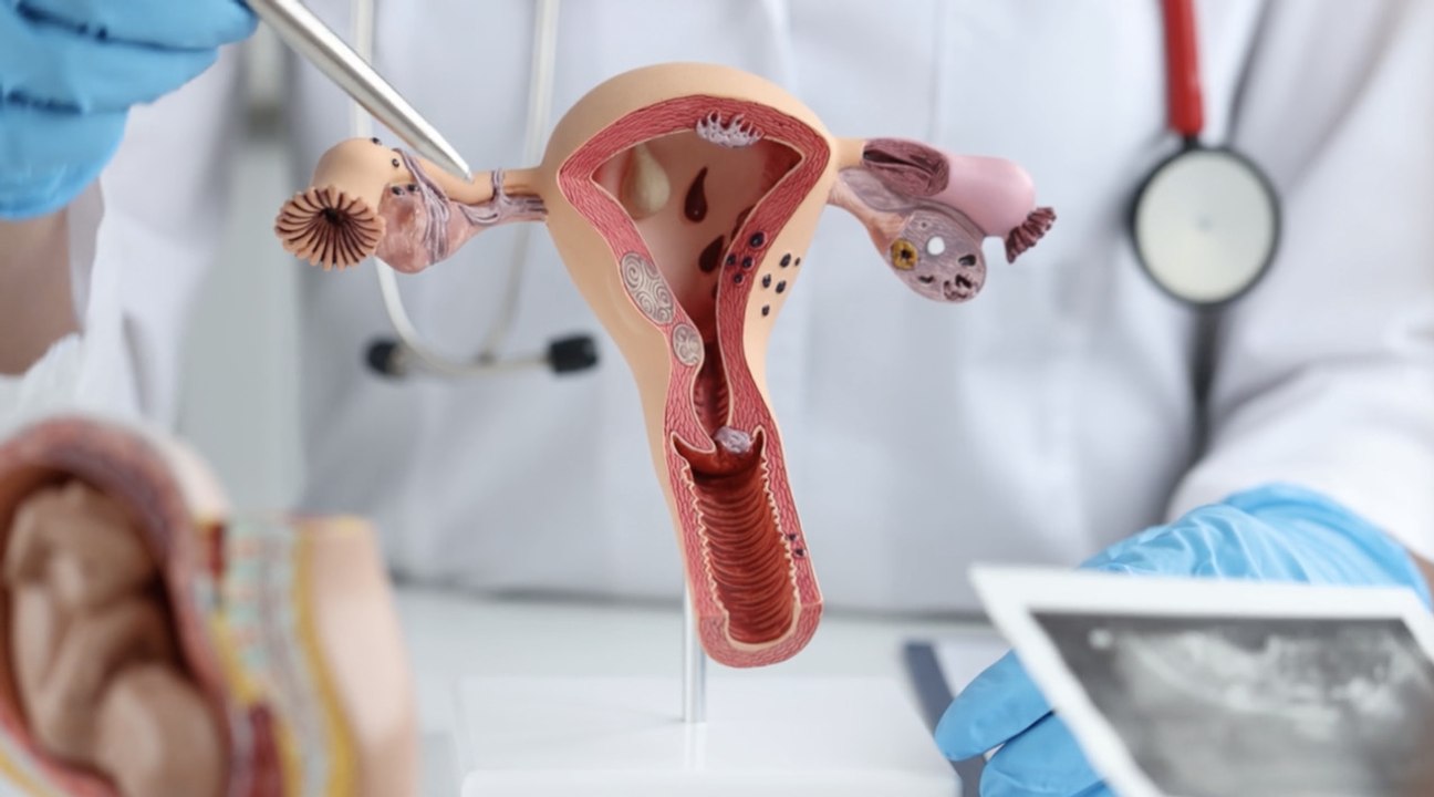 8 Early Signs of Ovarian Cancer