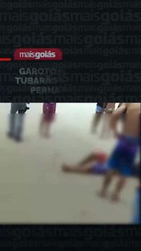 O adolescente de 14 anos que foi atacado por um tubarão neste domingo (5), em Jaboatão dos Guararapes (PE), na região metropolitana do Recife, teve a perna direita amputada. A informação foi divulgada na manhã desta segunda (6), pelo Hospital Restauração,