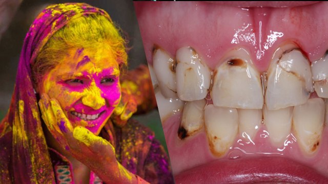 Holi 2023: दांतों से होली का रंग कैसे निकाले । Danto Se Holi Ka Rang Kaise Nikale । Boldsky