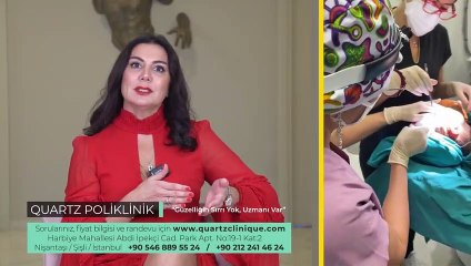 متى تظهر نتائج شد الوجه بالخيوط  | Leyla ARVAS,MD |  Quartz Clinique