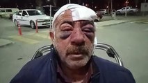 Konya'da Bir Vatandaş, Husumetlileri Tarafından Karakolda Darp Edildiği İddiasıyla Şikayette Bulundu