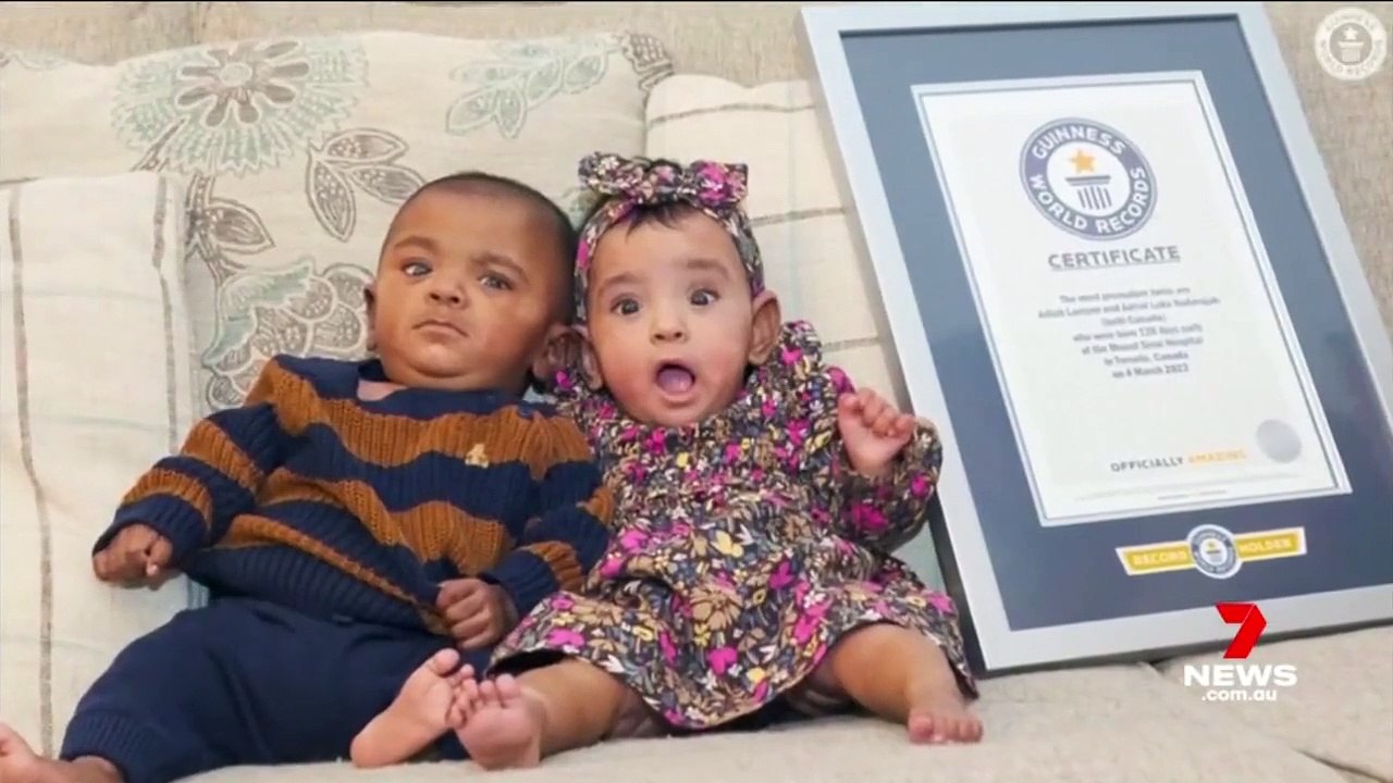 Des jumeaux canadiens nés prématurément et qui n'avaient, d'après les médecins, aucune chance de survie, viennent de fêter leur premier anniversaire!