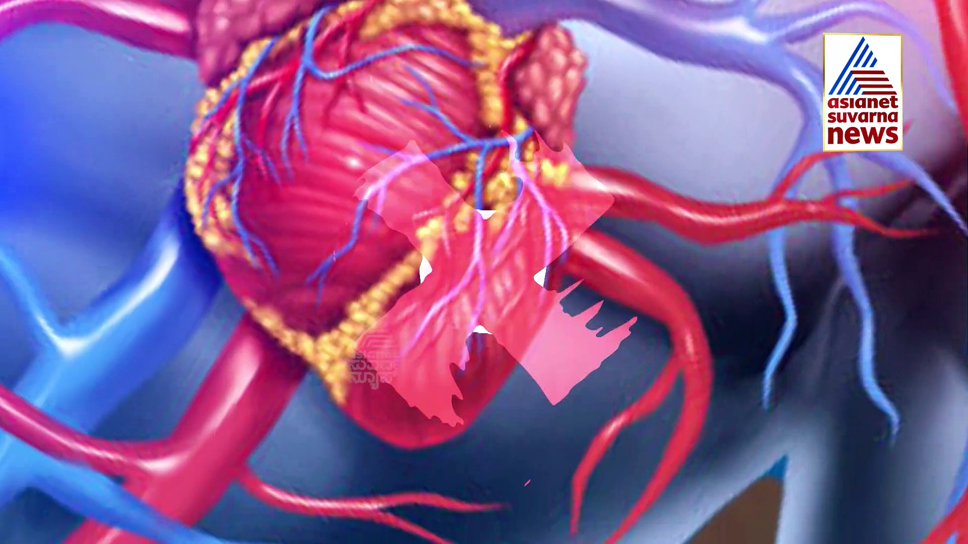 ಕೋವಿಡ್ ಬಳಿಕ  ಹೆಚ್ಚಾಯ್ತಾ ಹಾರ್ಟ್ಅಟ್ಯಾಕ್‌, ತಜ್ಞರು ಈ ಬಗ್ಗೆ ಏನ್‌ ಹೇಳ್ತಾರೆ?