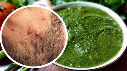 पुदीना की चटनी खाने के फायदे, पीरियड से लेकर हार्टबर्न तक में फायदेमंद । Boldsky