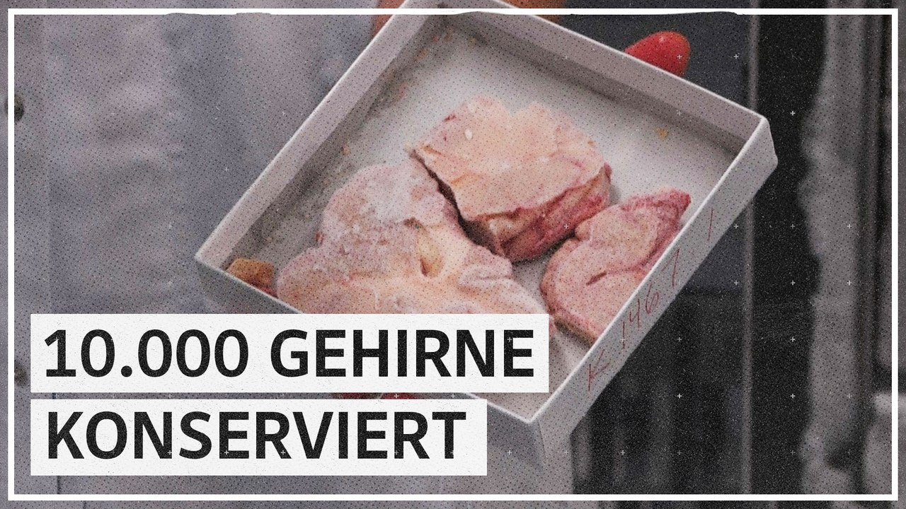 Dänemark: Ethisches Dilemma um rund 10.000 Hirne