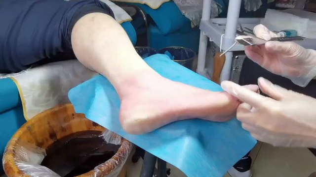 scuffed heels removing the hard and dead skin from the foot. Remove cracked heels.